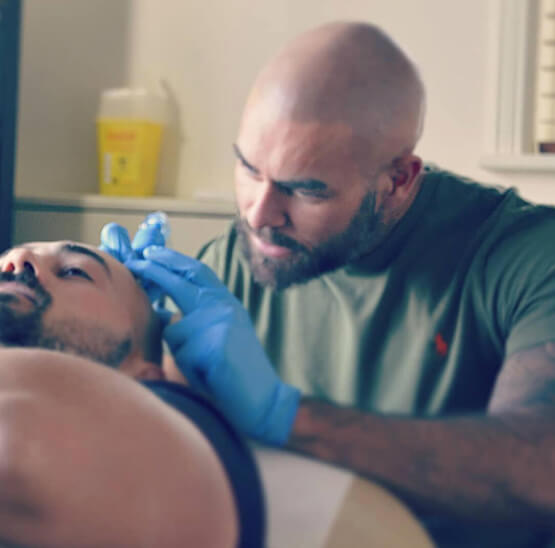 about scalp micropigmentation