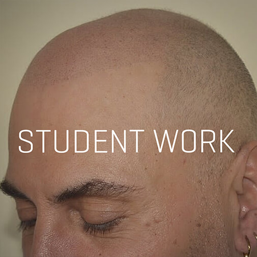 Scalp Micropigmentation Training