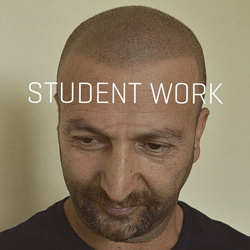 Scalp Micropigmentation Training