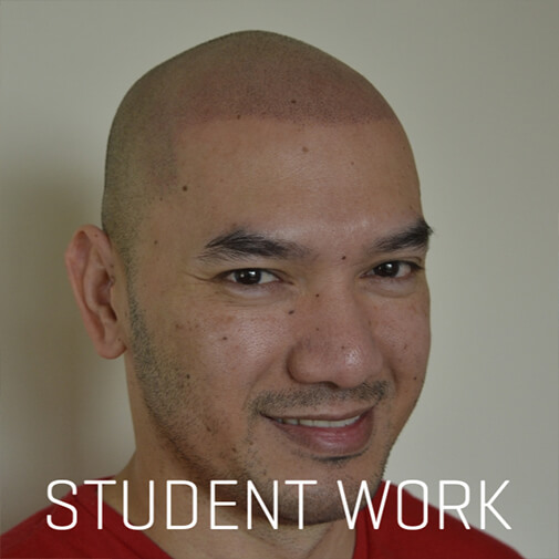 Scalp Micropigmentation Training