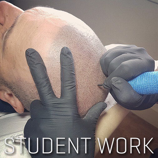Scalp Micropigmentation Training