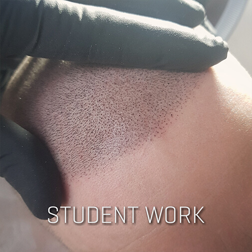 Scalp Micropigmentation Training