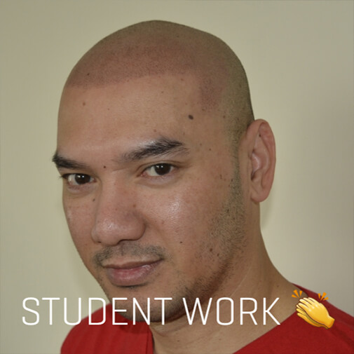 Scalp Micropigmentation Training