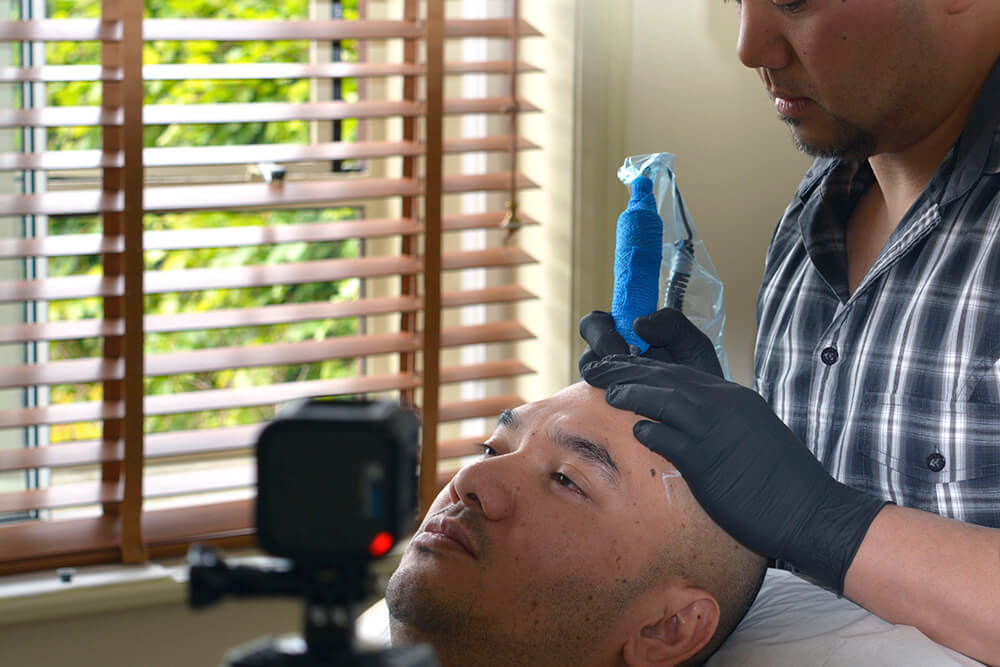 Scalp Micropigmentation Training