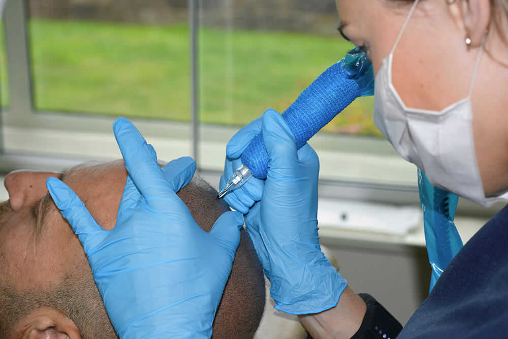 Scalp Micropigmentation Training